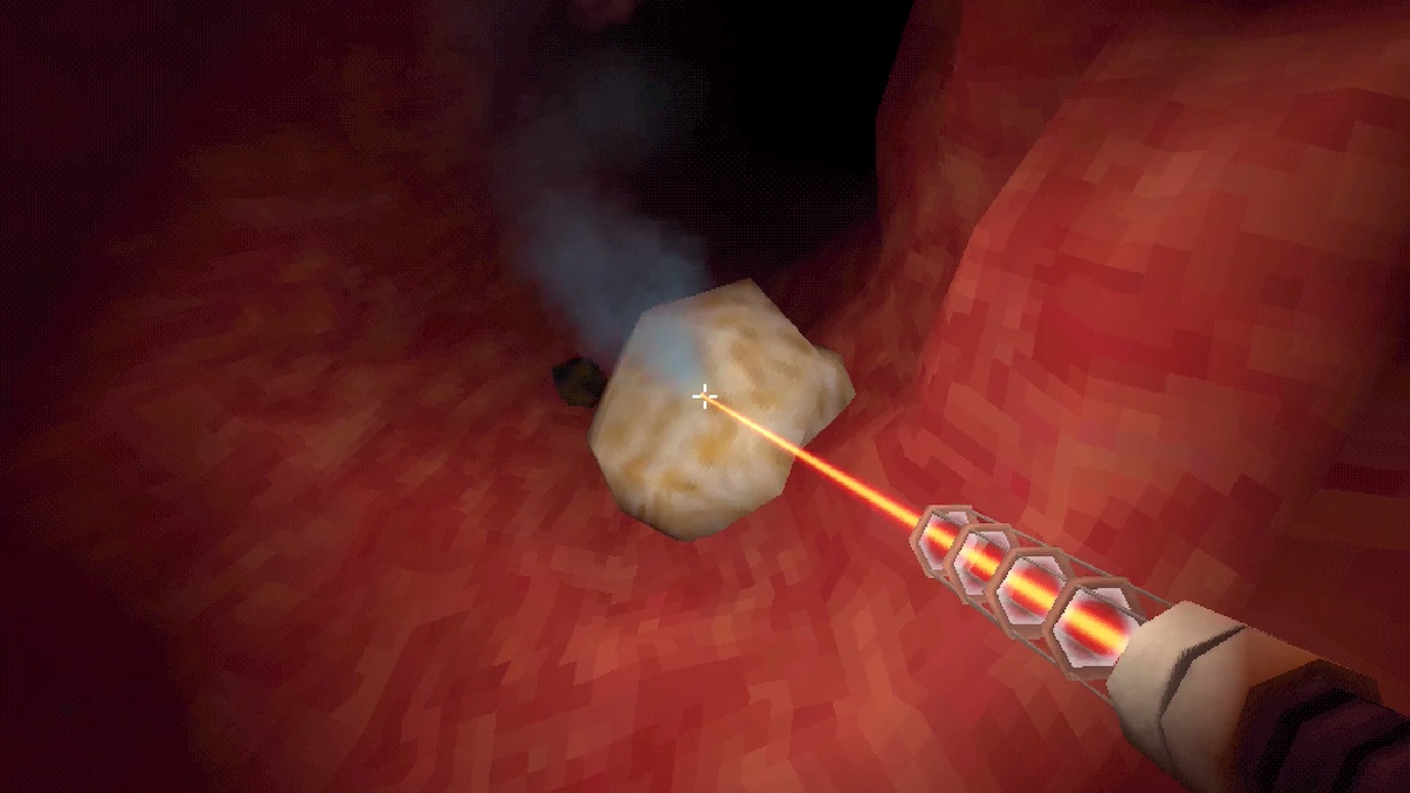 Using the endoscope's laser to clear blockages in Revenge Of The Colon