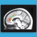 「脳トレゲーム」の効果を示す研究結果。10週間の脳トレが、脳の一部で“老化10年分”を打ち消す可能性 20251028-363921-header